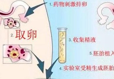 济南地区有哪些私立的机构可以做试管技术？马来西亚试管婴儿费用攻略