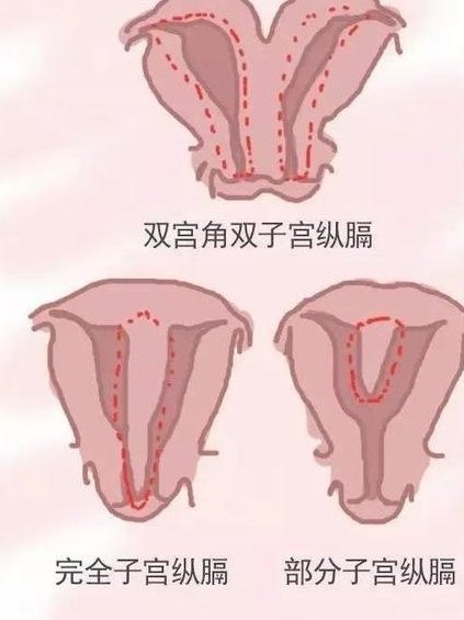 试管婴儿移植后如何检测怀孕？