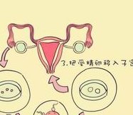 详细解读海南省做长方案试管婴儿费用，长方案和短方案成功率有差别吗？