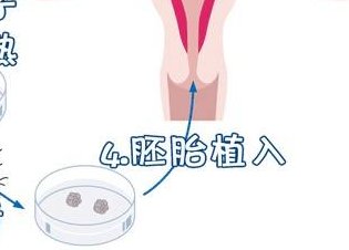 沈阳三代试管哪家医院好？