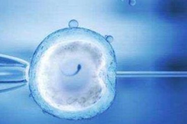 在宁波高龄做试管会有什么并发症？试管婴儿技术并发症都有哪些？